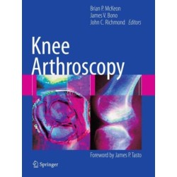 Knee Arthroscopy