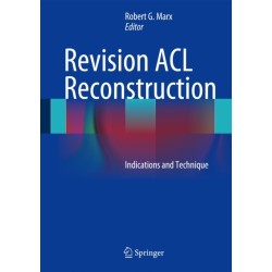 Revision ACL Reconstruction: Indications and Technique