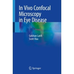 In Vivo Confocal Microscopy in Eye Disease