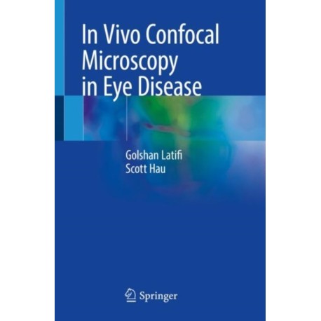 In Vivo Confocal Microscopy in Eye Disease