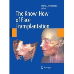 The Know-How of Face Transplantation