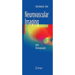 Neurovascular Imaging: MRI & Microangiography