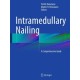 Intramedullary Nailing: A Comprehensive Guide