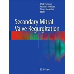 Secondary Mitral Valve Regurgitation