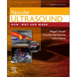 Vascular Ultrasound: How, Why and When