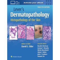 Lever's Dermatopathology: Histopathology of the Skin: Histopathology of the Skin