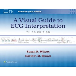 A Visual Guide to ECG Interpretation: Print + eBook with Multimedia