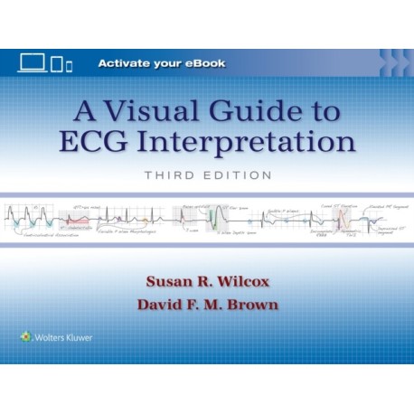 A Visual Guide to ECG Interpretation: Print + eBook with Multimedia