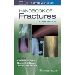 Handbook of Fractures