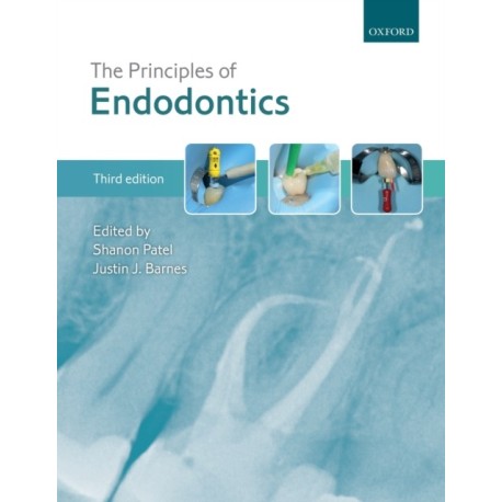 The Principles of Endodontics