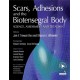 Scars, Adhesions and the Biotensegral Body: Science, Assessment and Treatment