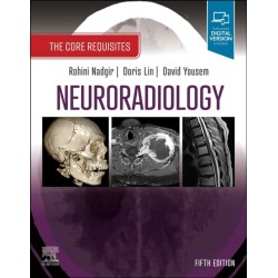 Neuroradiology: The Core Requisites