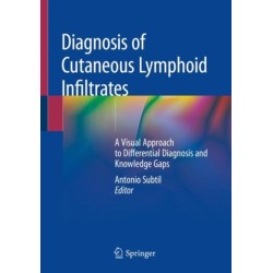 Diagnosis of Cutaneous Lymphoid Infiltrates: A Visual Approach to Differential Diagnosis and Knowledge Gaps