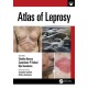 Atlas of Leprosy