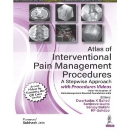 Atlas of Interventional Pain Management Procedures: A Stepwise Approach