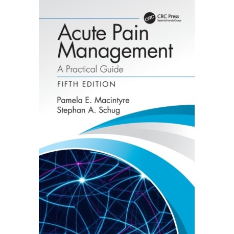 Acute Pain Management: A Practical Guide