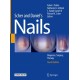 Scher and Daniel's Nails: Diagnosis, Surgery, Therapy