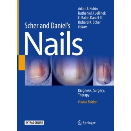 Scher and Daniel's Nails: Diagnosis, Surgery, Therapy