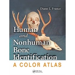 Human and Nonhuman Bone Identification: A Color Atlas