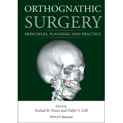 Orthognathic Surgery: Principles, Planning and Practice