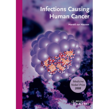 Infections Causing Human Cancer: Softcover Edition