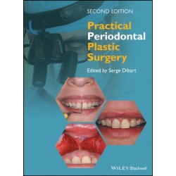 Practical Periodontal Plastic Surgery