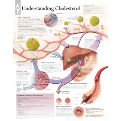 Understanding Cholesterol Laminated Poster