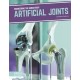 Artificial Joints