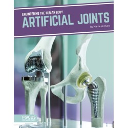 Artificial Joints