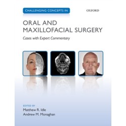 Challenging Concepts in Oral and Maxillofacial Surgery: Cases with Expert Commentary