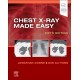 Chest X-Ray Made Easy