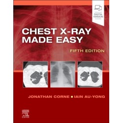 Chest X-Ray Made Easy