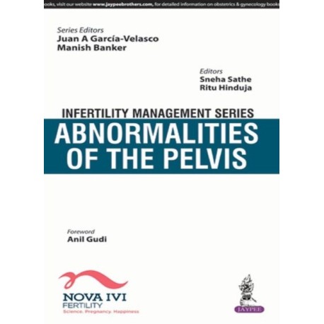 Infertility Management Series: Abnormalities of the Pelvis