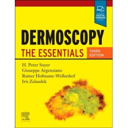Dermoscopy: The Essentials