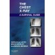 The Chest X-Ray: A Survival Guide