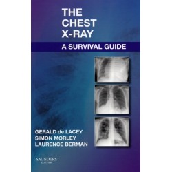 The Chest X-Ray: A Survival Guide