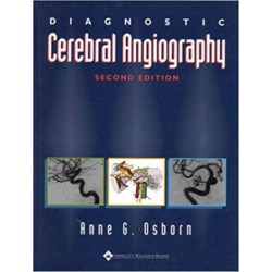 Diagnostic Cerebral Angiography
