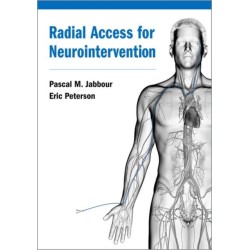 Radial Access for Neurointervention
