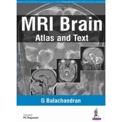 MRI Brain: Atlas and Text