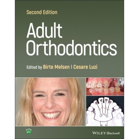 Adult Orthodontics