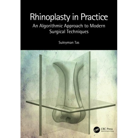 Rhinoplasty in Practice: An Algorithmic Approach to Modern Surgical Techniques
