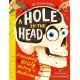 A Hole in the Head: A gruesomely grisly history of medical firsts