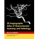 3D Angiographic Atlas of Neurovascular Anatomy and Pathology