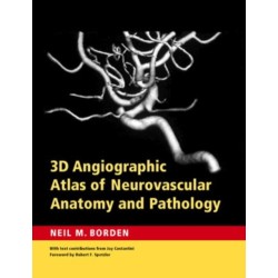 3D Angiographic Atlas of Neurovascular Anatomy and Pathology