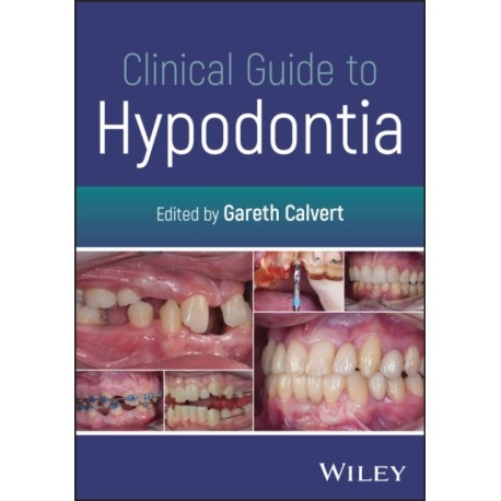 Clinical Guide to Hypodontia