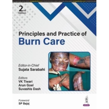 Principles and Practice of Burn Care