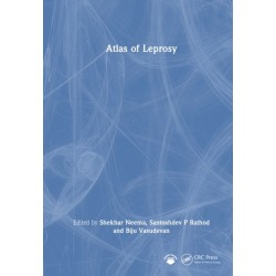 Atlas of Leprosy