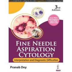 Fine Needle Aspiration Cytology: Interpretation and Diagnostic Difficulties