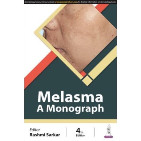 Melasma: A Monograph