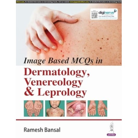 Image Based MCQs in Dermatology, Venereology & Leprology